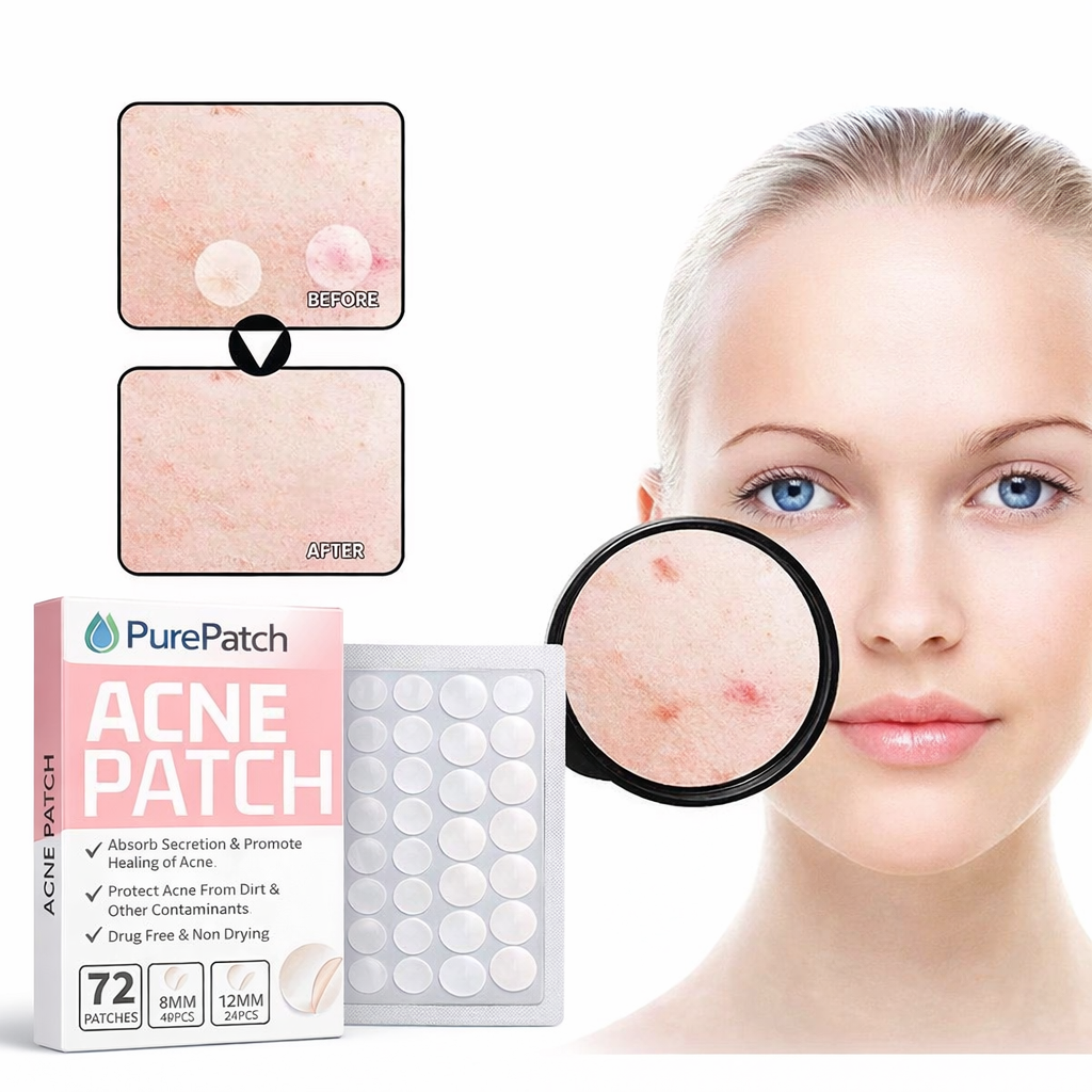 hydrocolloid acne patches